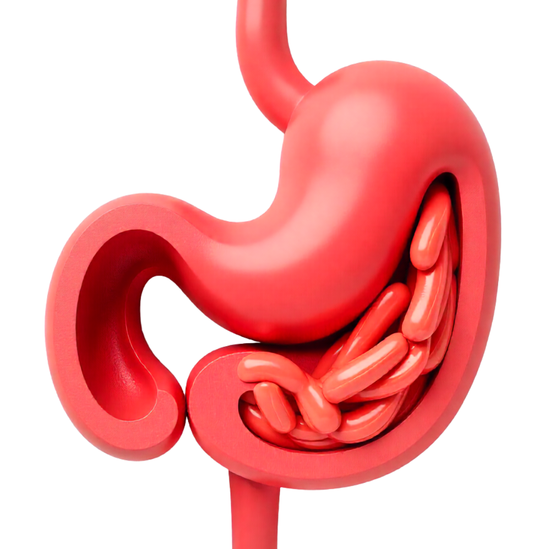 Medical illustration of bariatric surgery showing stomach reduction for weight loss treatment at Vasavi Hospitals Bangalore